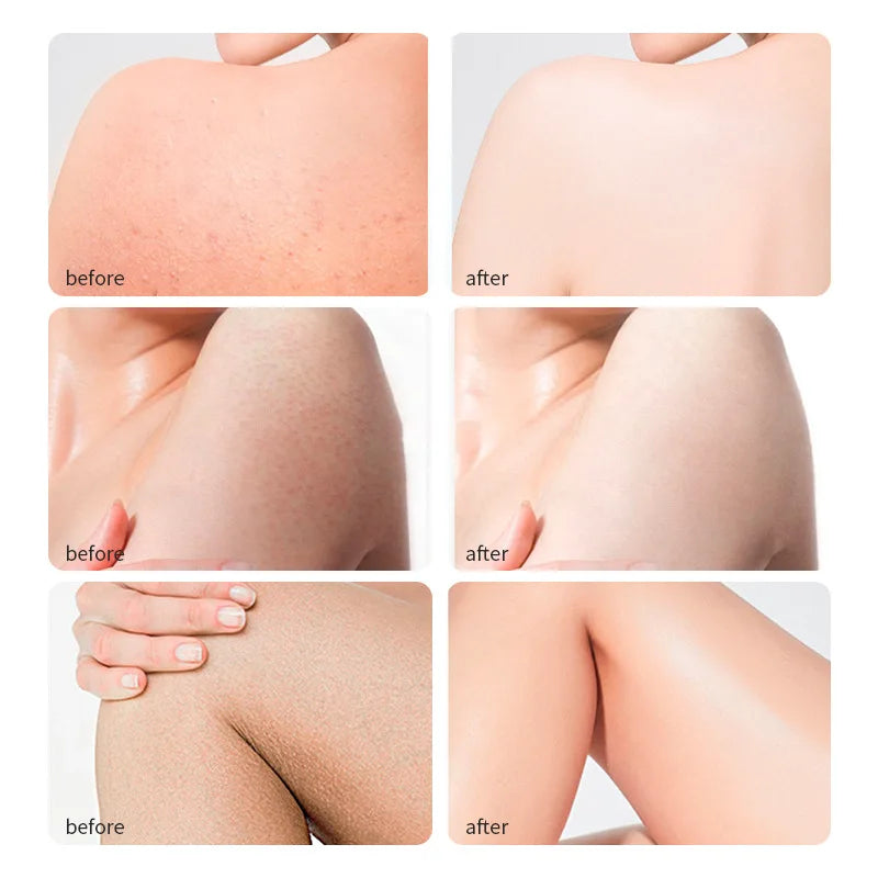 Aceite Ricino Prensado Frío 100% Natural Puro Chile